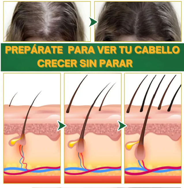 OUHOE - CRECIMIENTO DE CABELLO